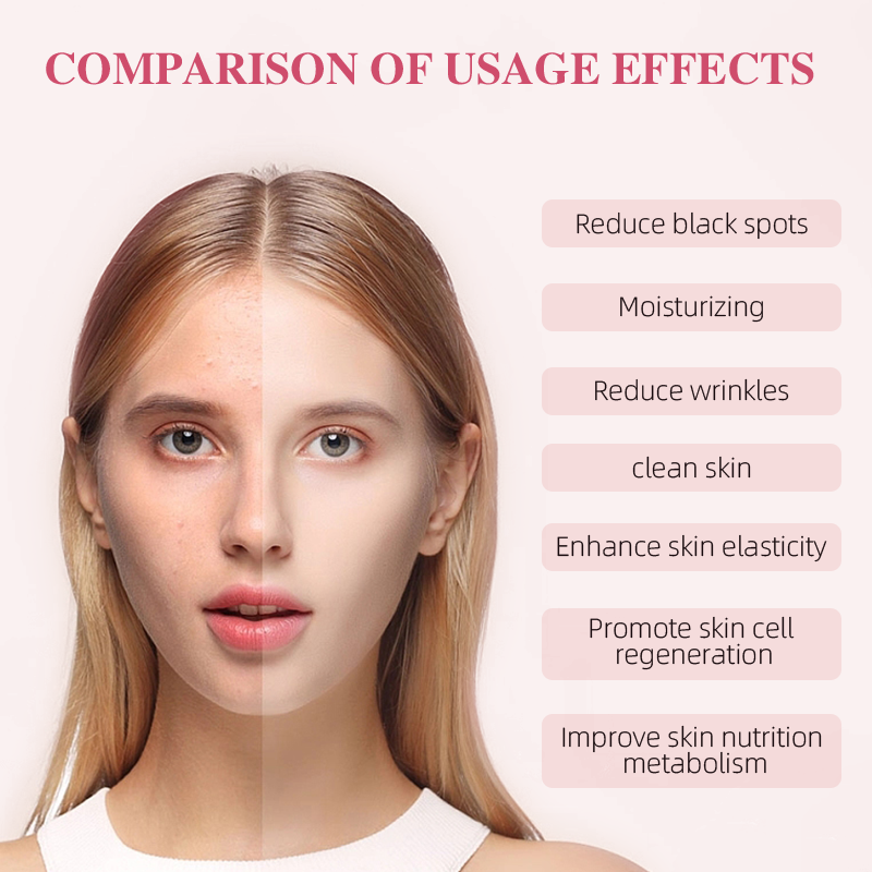 5IN1 Set skin care